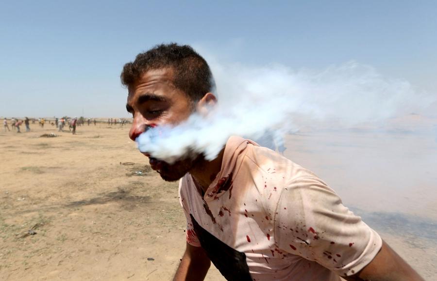 Tear gas streams from a man's face after he is hit in the face with a tear gas canister