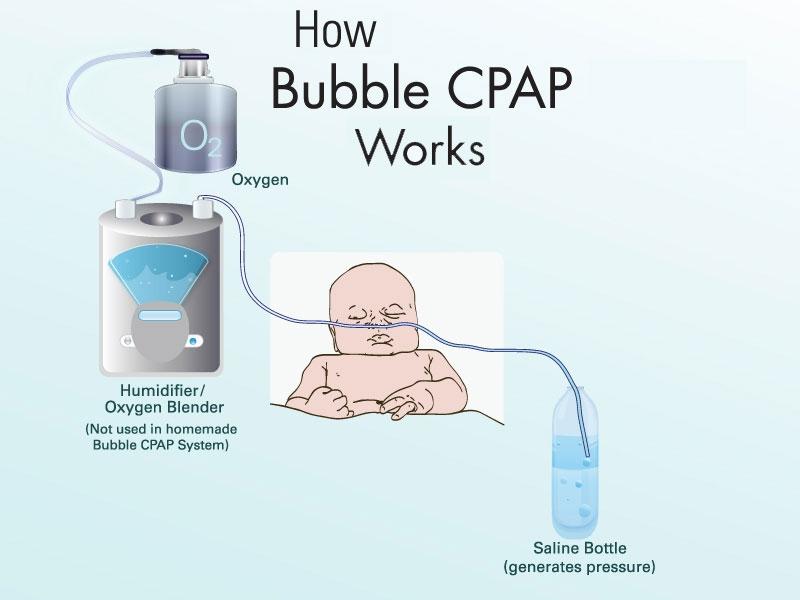 Bubble CPAP Graphic