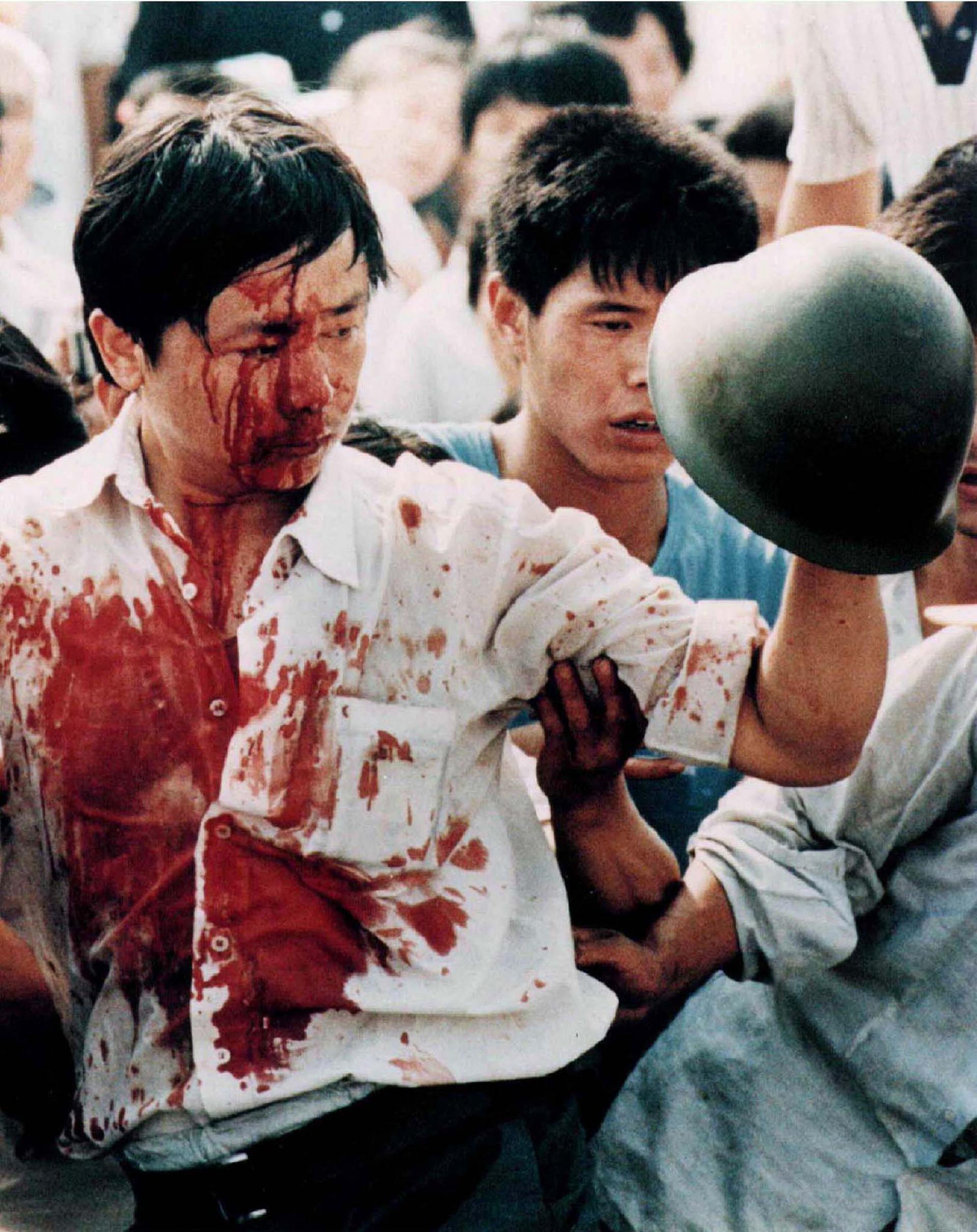 A man is covered in blood while holding up a military helmet. 