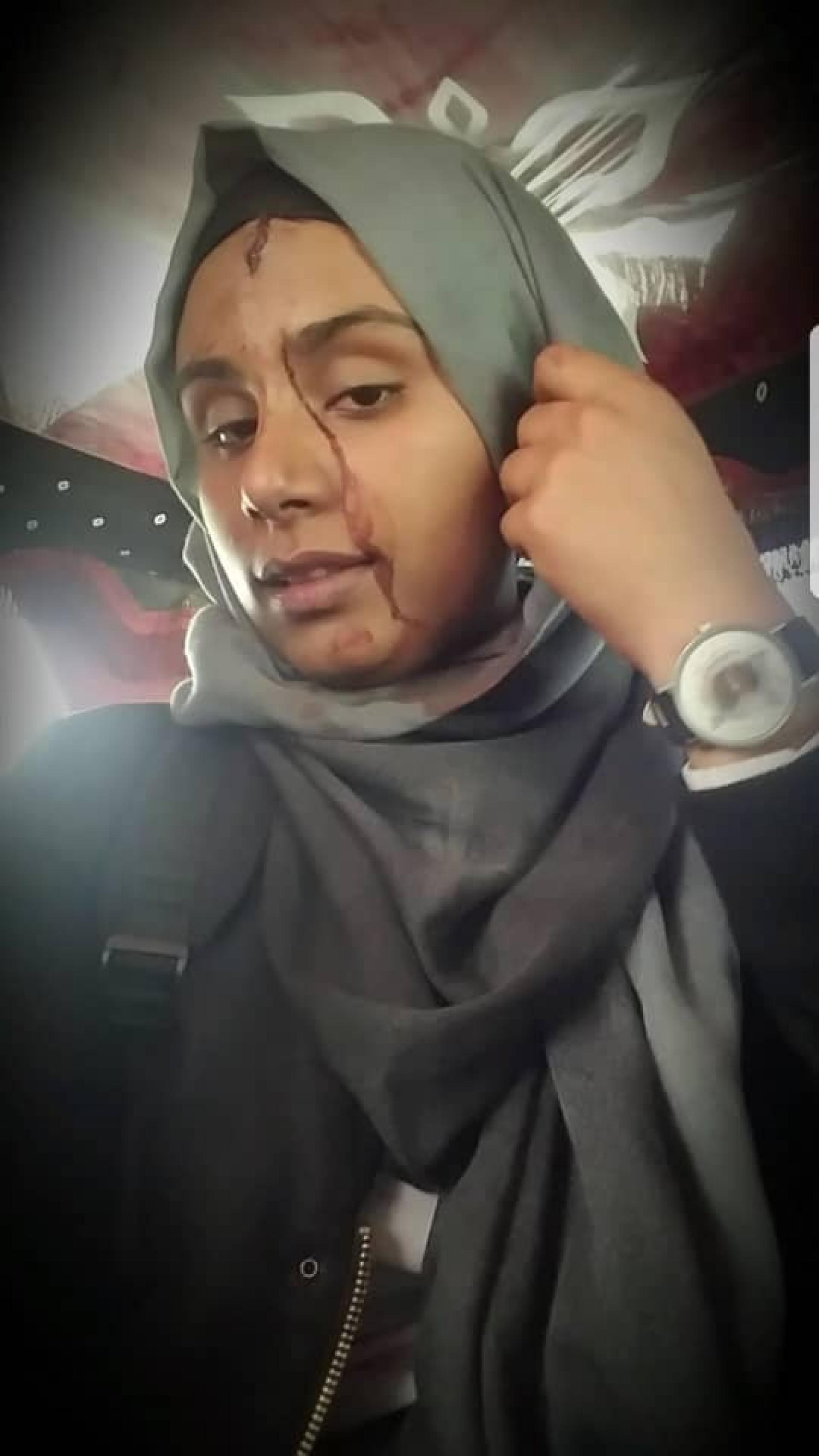 Selfie of woman wearing a gray hijab with bloody trickling down her face. 