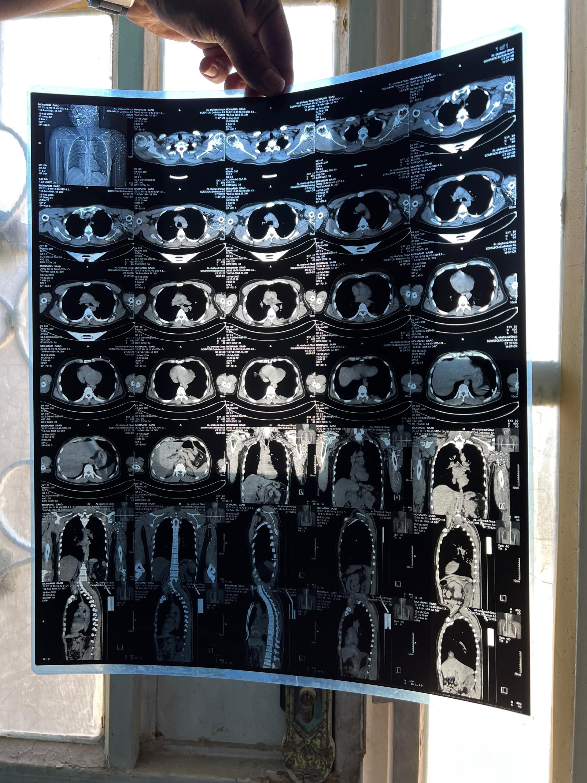 X-rays on display