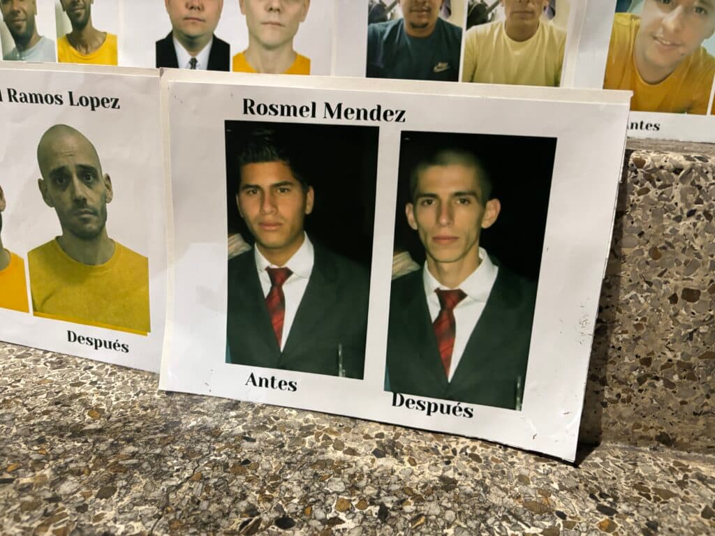 Two photographs labeled "Before" and "After" of the same individual wearing a suit with a red tie, showing a noticeable change in appearance and facial features.