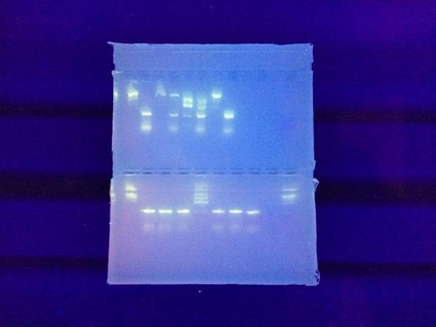 In another exercise, Wetherell experimented with her own DNA. After amplifying the  DNA samples in a polymerase chain reaction machine (Slide 2), Wetherell pipetted them into an agarose gel (above). 